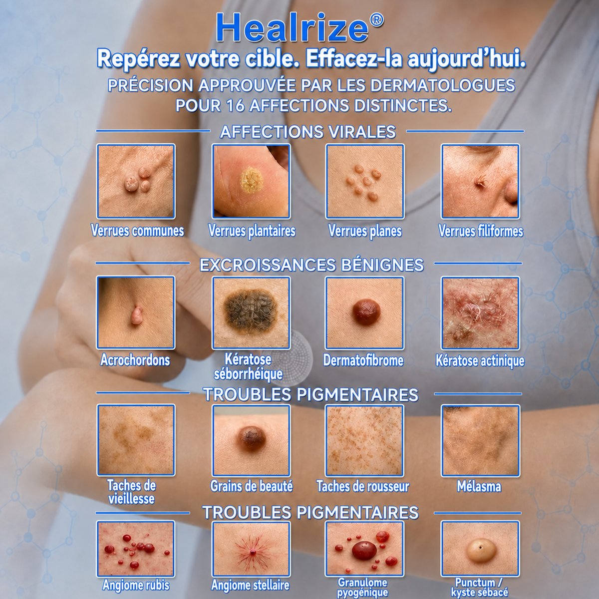 🧑‍⚕️𝐵𝑜𝑢𝑡𝑖𝑞𝑢𝑒 𝑂𝑓𝑓𝑖𝑐𝑖𝑒𝑙𝑙𝑒 | Healrize® 🌿 𝑴𝒊𝒄𝒓𝒐𝒏𝒆𝒆𝒅𝒍𝒆𝒔 – 𝑺𝒐𝒊𝒏 𝑪𝒊𝒃𝒍𝒆́ 𝒑𝒐𝒖𝒓 𝒖𝒏𝒆 𝑷𝒆𝒂𝒖 𝑷𝒍𝒖𝒔 𝑳𝒊𝒔𝒔𝒆 𝒆𝒕 𝑷𝒂𝒓𝒇𝒂𝒊𝒕𝒆 (𝑃𝑜𝑢𝑟 𝑙𝑒𝑠 𝑎𝑐𝑟𝑜𝑐ℎ𝑜𝑟𝑑𝑜𝑛𝑠, 𝑙𝑒𝑠 𝑝𝑒𝑡𝑖𝑡𝑒𝑠 𝑒𝑥𝑐𝑟𝑜𝑖𝑠𝑠𝑎𝑛𝑐𝑒𝑠 𝑐𝑢𝑡𝑎𝑛é𝑒𝑠, 𝑙𝑒𝑠 𝑣𝑒𝑟𝑟𝑢𝑒𝑠, 𝑙𝑒𝑠 𝑔𝑟𝑎𝑖𝑛𝑠 𝑑𝑒 𝑏𝑒𝑎𝑢𝑡é, 𝑙𝑒𝑠 𝑡𝑎𝑐ℎ𝑒𝑠 𝑑𝑒 𝑣𝑖𝑒𝑖𝑙𝑙𝑒𝑠𝑠𝑒 𝑒𝑡 𝑙𝑒𝑠 𝑝𝑟𝑜𝑏𝑙è𝑚𝑒𝑠 𝑑𝑒 𝑝𝑖𝑔𝑚𝑒𝑛𝑡𝑎𝑡𝑖𝑜𝑛)
