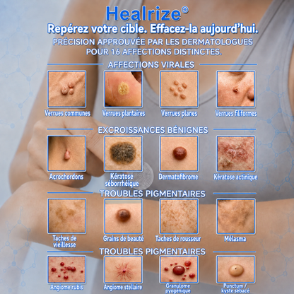 🧑‍⚕️𝐵𝑜𝑢𝑡𝑖𝑞𝑢𝑒 𝑂𝑓𝑓𝑖𝑐𝑖𝑒𝑙𝑙𝑒 | Healrize® 🌿 𝑴𝒊𝒄𝒓𝒐𝒏𝒆𝒆𝒅𝒍𝒆𝒔 – 𝑺𝒐𝒊𝒏 𝑪𝒊𝒃𝒍𝒆́ 𝒑𝒐𝒖𝒓 𝒖𝒏𝒆 𝑷𝒆𝒂𝒖 𝑷𝒍𝒖𝒔 𝑳𝒊𝒔𝒔𝒆 𝒆𝒕 𝑷𝒂𝒓𝒇𝒂𝒊𝒕𝒆 (𝑃𝑜𝑢𝑟 𝑙𝑒𝑠 𝑎𝑐𝑟𝑜𝑐ℎ𝑜𝑟𝑑𝑜𝑛𝑠, 𝑙𝑒𝑠 𝑝𝑒𝑡𝑖𝑡𝑒𝑠 𝑒𝑥𝑐𝑟𝑜𝑖𝑠𝑠𝑎𝑛𝑐𝑒𝑠 𝑐𝑢𝑡𝑎𝑛é𝑒𝑠, 𝑙𝑒𝑠 𝑣𝑒𝑟𝑟𝑢𝑒𝑠, 𝑙𝑒𝑠 𝑔𝑟𝑎𝑖𝑛𝑠 𝑑𝑒 𝑏𝑒𝑎𝑢𝑡é, 𝑙𝑒𝑠 𝑡𝑎𝑐ℎ𝑒𝑠 𝑑𝑒 𝑣𝑖𝑒𝑖𝑙𝑙𝑒𝑠𝑠𝑒 𝑒𝑡 𝑙𝑒𝑠 𝑝𝑟𝑜𝑏𝑙è𝑚𝑒𝑠 𝑑𝑒 𝑝𝑖𝑔𝑚𝑒𝑛𝑡𝑎𝑡𝑖𝑜𝑛)