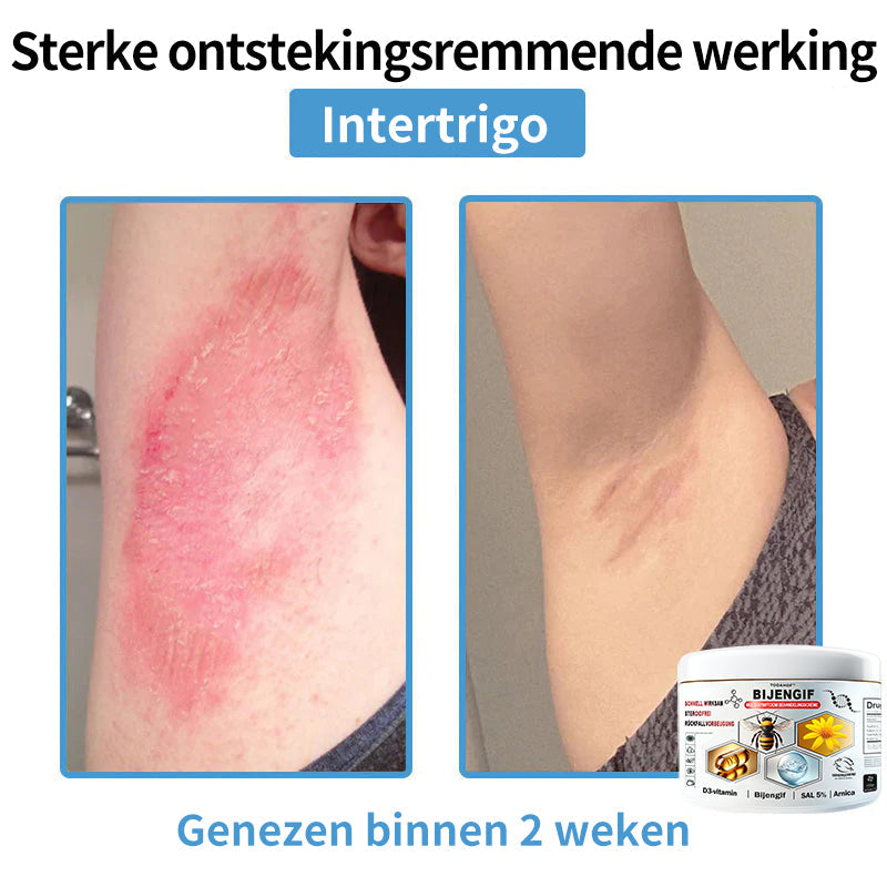 【Alleen nog 30 MINUTEN – Actie eindigt binnenkort!⏰⏰】
