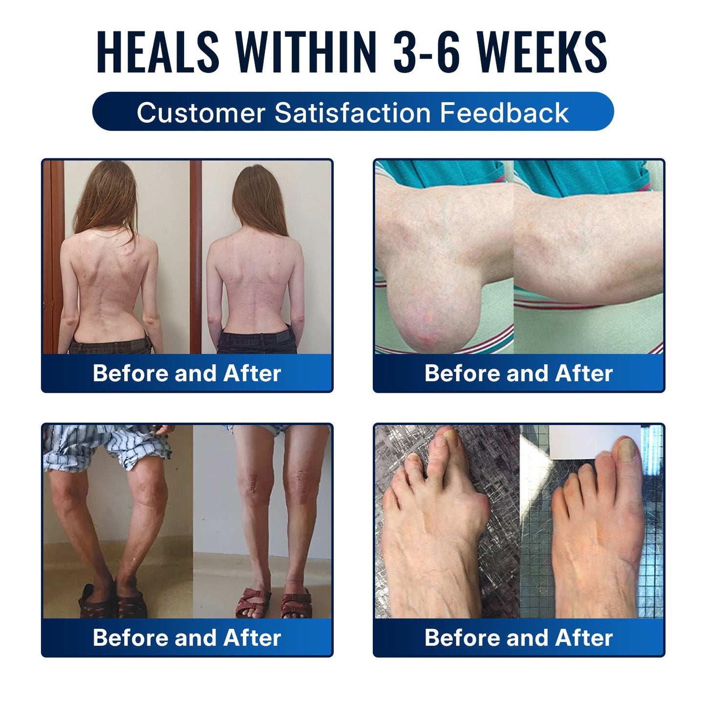 🎁Healrize® Bee Venom Joint Relief Cream 💞Targets stiff, sore joints in knees, hands, shoulders, back & more — so you can move easier every day