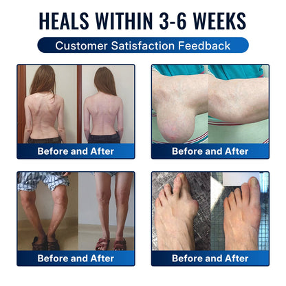 🎁Healrize® Bee Venom Joint Relief Cream 💞Targets stiff, sore joints in knees, hands, shoulders, back & more — so you can move easier every day