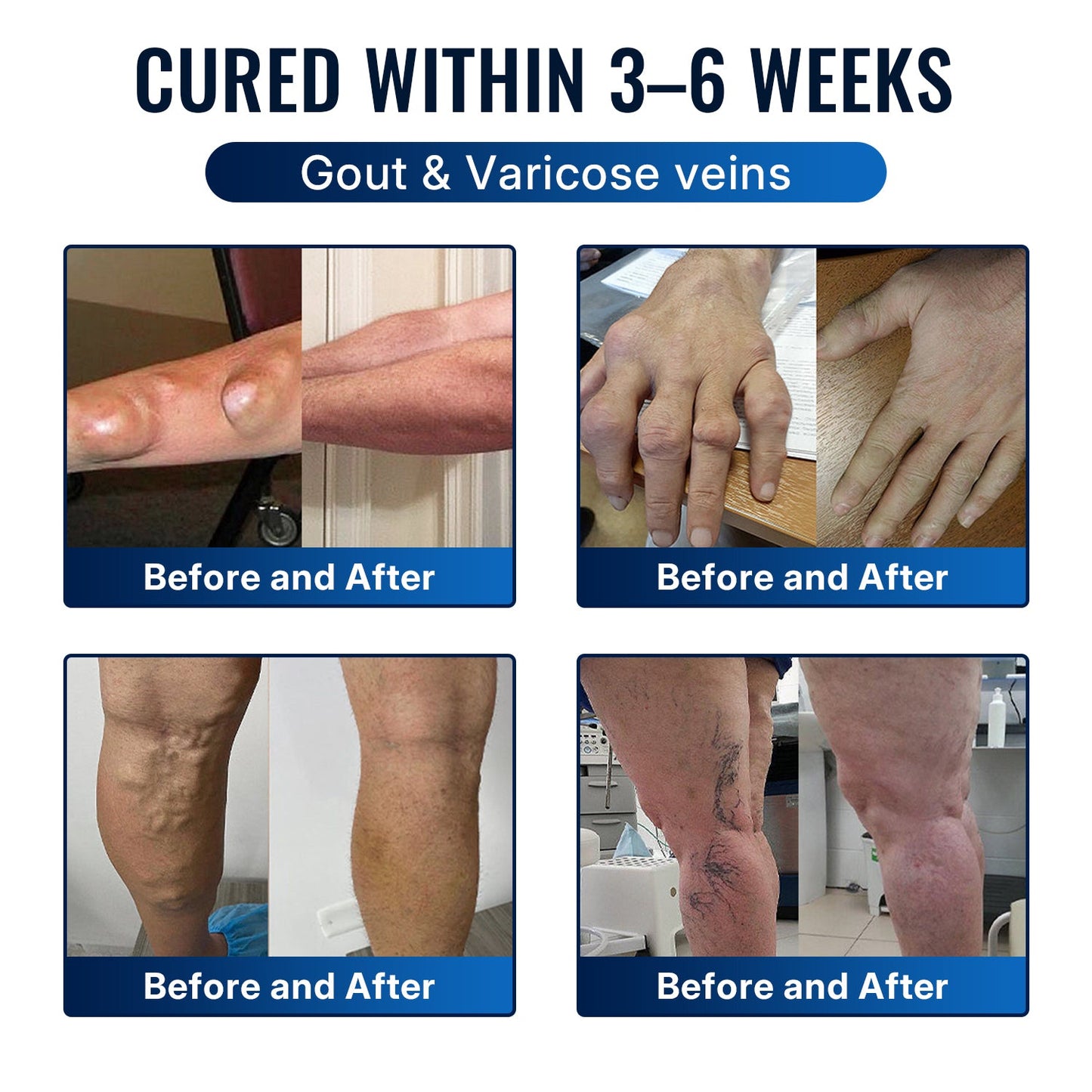 🎁Healrize® Bee Venom Joint Relief Cream 💞Targets stiff, sore joints in knees, hands, shoulders, back & more — so you can move easier every day