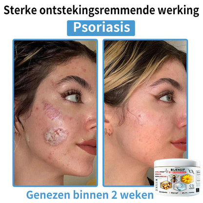 【Alleen nog 30 MINUTEN – Actie eindigt binnenkort!⏰⏰】