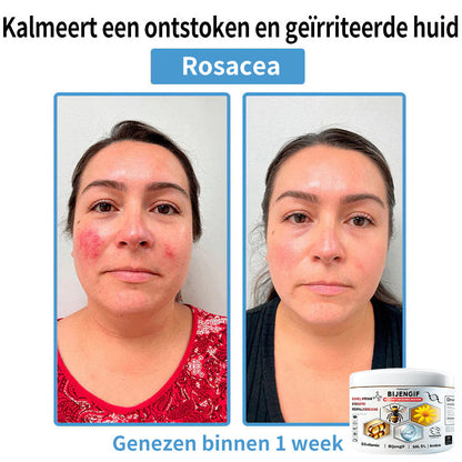【Alleen nog 30 MINUTEN – Actie eindigt binnenkort!⏰⏰】