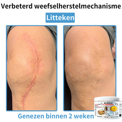 【Alleen nog 30 MINUTEN – Actie eindigt binnenkort!⏰⏰】