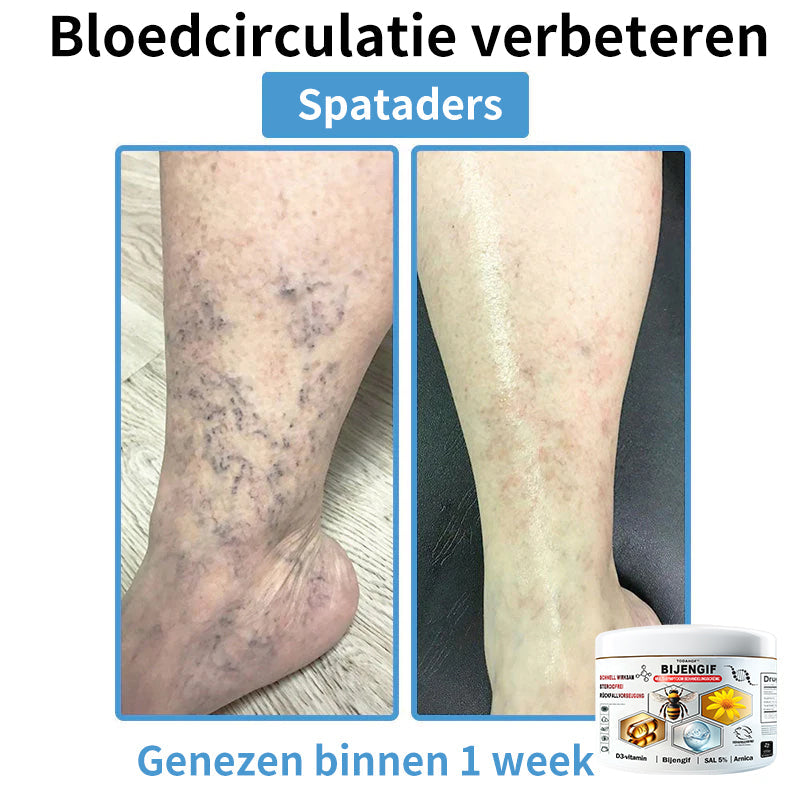 【Alleen nog 30 MINUTEN – Actie eindigt binnenkort!⏰⏰】