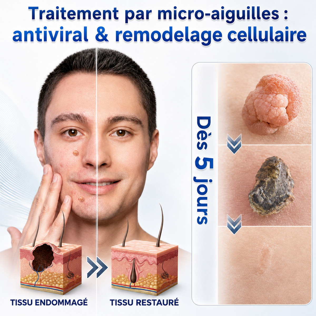 🏠 𝐵𝑜𝑢𝑡𝑖𝑞𝑢𝑒 𝑂𝑓𝑓𝑖𝑐𝑖𝑒𝑙𝑙𝑒 | Healrize® 🌿 𝑴𝒊𝒄𝒓𝒐𝒏𝒆𝒆𝒅𝒍𝒆𝒔 – 𝑺𝒐𝒊𝒏 𝑪𝒊𝒃𝒍𝒆́ 𝒑𝒐𝒖𝒓 𝒖𝒏𝒆 𝑷𝒆𝒂𝒖 𝑷𝒍𝒖𝒔 𝑳𝒊𝒔𝒔𝒆 𝒆𝒕 𝑷𝒂𝒓𝒇𝒂𝒊𝒕𝒆 (𝑃𝑜𝑢𝑟 𝑙𝑒𝑠 𝑎𝑐𝑟𝑜𝑐ℎ𝑜𝑟𝑑𝑜𝑛𝑠, 𝑙𝑒𝑠 𝑝𝑒𝑡𝑖𝑡𝑒𝑠 𝑒𝑥𝑐𝑟𝑜𝑖𝑠𝑠𝑎𝑛𝑐𝑒𝑠 𝑐𝑢𝑡𝑎𝑛é𝑒𝑠, 𝑙𝑒𝑠 𝑣𝑒𝑟𝑟𝑢𝑒𝑠, 𝑙𝑒𝑠 𝑔𝑟𝑎𝑖𝑛𝑠 𝑑𝑒 𝑏𝑒𝑎𝑢𝑡é, 𝑙𝑒𝑠 𝑡𝑎𝑐ℎ𝑒𝑠 𝑑𝑒 𝑣𝑖𝑒𝑖𝑙𝑙𝑒𝑠𝑠𝑒 𝑒𝑡 𝑙𝑒𝑠 𝑝𝑟𝑜𝑏𝑙è𝑚𝑒𝑠 𝑑𝑒 𝑝𝑖𝑔𝑚𝑒𝑛𝑡𝑎𝑡𝑖𝑜𝑛）